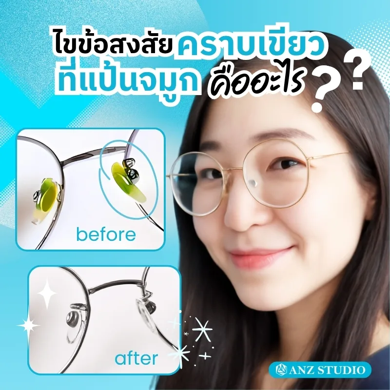 คราบเขียวตรงแป้นจมูกเกิดจากอะไร ?
