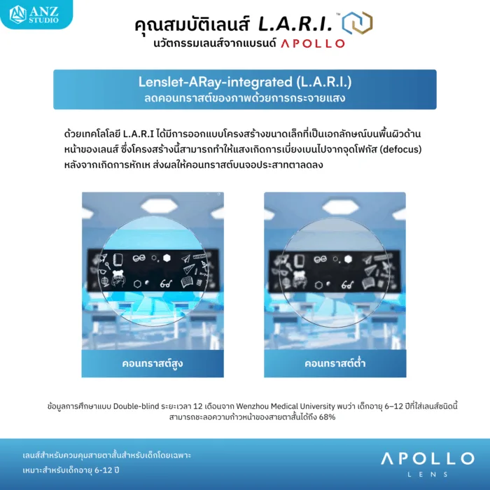 ตัดเลนส์สายตา Apollo L.A.R.I. เลนส์ควบคุมสายตาสั้นสำหรับเด็ก 6-12 ปี - Image 4