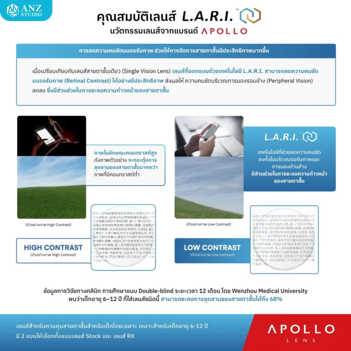ตัดเลนส์สายตา Apollo L.A.R.I. เลนส์ควบคุมสายตาสั้นสำหรับเด็ก 6-12 ปี - Image 3