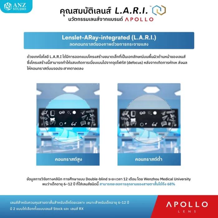 ตัดเลนส์สายตา Apollo L.A.R.I. เลนส์ควบคุมสายตาสั้นสำหรับเด็ก 6-12 ปี - Image 4
