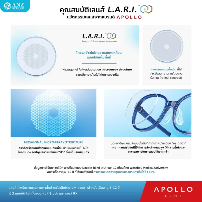ตัดเลนส์สายตา Apollo L.A.R.I. เลนส์ควบคุมสายตาสั้นสำหรับเด็ก 6-12 ปี - Image 5