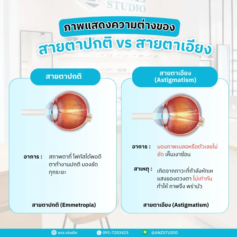 สายตาเอียง(Astigmatism) เกิดจากอะไร สาเหตุ อาการ และวิธีรักษาที่ช่วยได้
