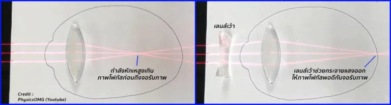 Acommodation_Concave_Lens