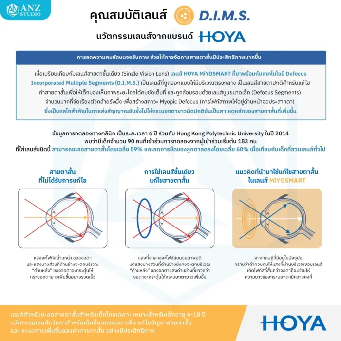 (RX) HOYA MiYOSMART เลนส์สายตาสำหรับชะลอสายตาสั้นในเด็ก 6-18 ปี ให้การมองเห็นที่คมชัด ปลอดภัย และเหมาะสมกับทุกกิจกรรมในชีวิตประจำวัน - Image 3