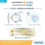 (RX) HOYA MiYOSMART เลนส์สายตาสำหรับชะลอสายตาสั้นในเด็ก 6-18 ปี ให้การมองเห็นที่คมชัด ปลอดภัย และเหมาะสมกับทุกกิจกรรมในชีวิตประจำวัน - Image 4