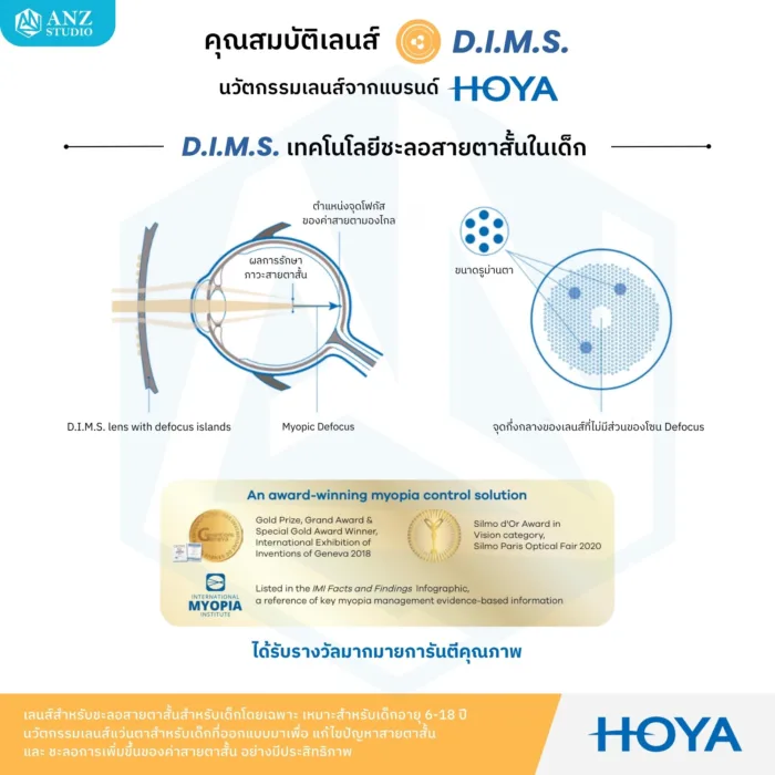 (RX) HOYA MiYOSMART เลนส์สายตาสำหรับชะลอสายตาสั้นในเด็ก 6-18 ปี ให้การมองเห็นที่คมชัด ปลอดภัย และเหมาะสมกับทุกกิจกรรมในชีวิตประจำวัน - Image 4