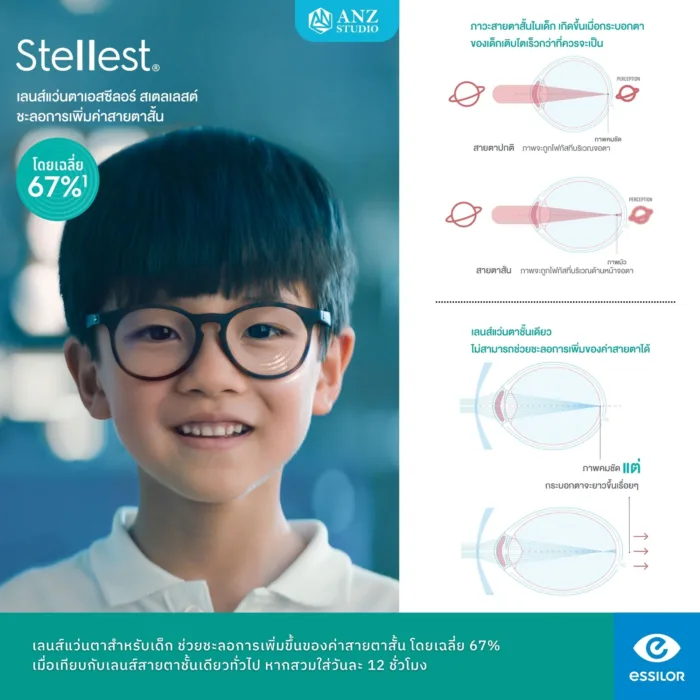 (RX) ตัดเลนส์สายตา Essilor Stellest เลนส์ควบคุมชะลอสายตาสั้นสำหรับเด็ก - Image 2
