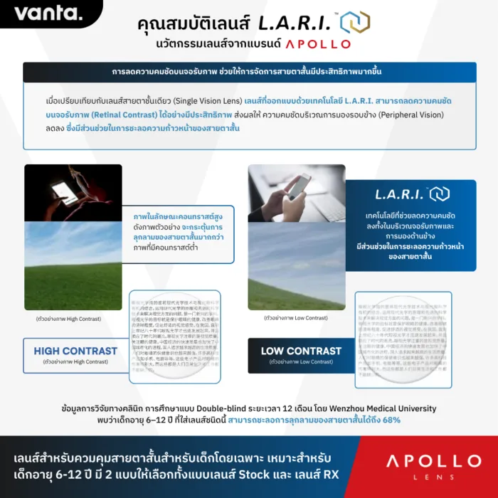 แว่นชะลอสายตาสั้นเด็ก vanta. CLOUDPLAY Brick สำหรับเด็กอายุ 6–12 ปีกรุณาทักแชทส่งใบค่าสายตาและสอบถามชนิดเลนส์ก่อนสั่งซื้อ - Image 6